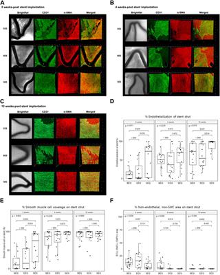 Faster smooth muscle cell coverage in ultrathin-strut drug-eluting stent leads to earlier re-endothelialization